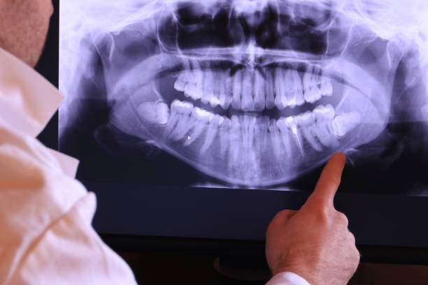 Best Tooth Infection Emergency Dentist  in Egypt Lake Leto, FL