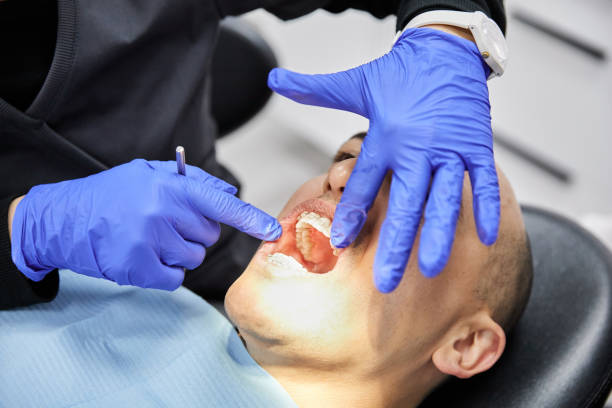 Best Broken Tooth Emergency  in Egypt Lake Leto, FL